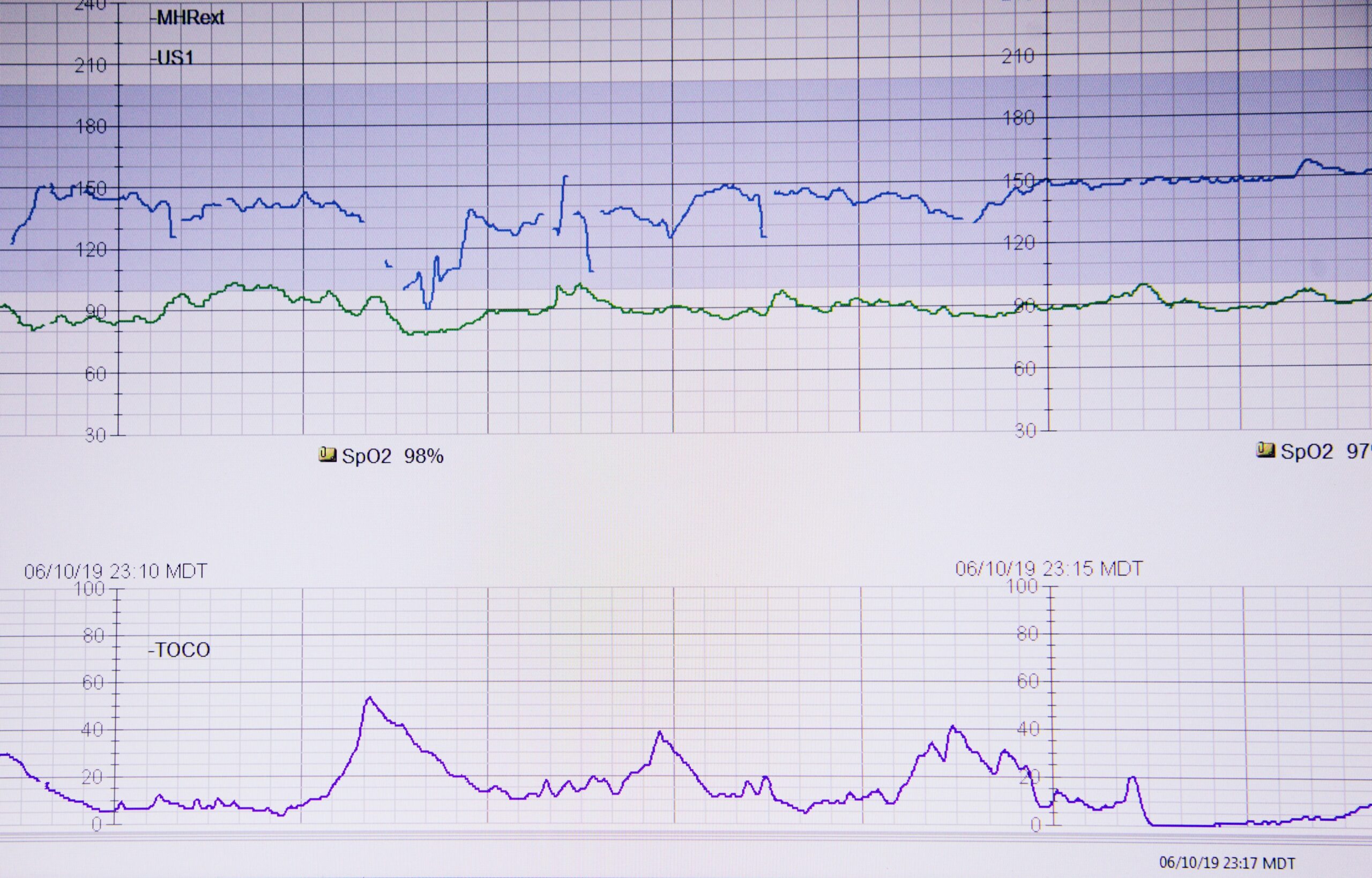 Before and after graphs showing improved reading metrics